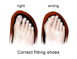 AuraPlastic Feet Illustration