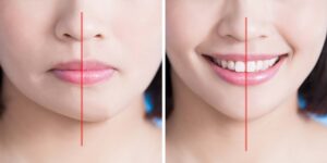 AuraPlastic Nose Correction