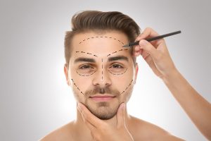 Image showing cosmetic surgery plan for Man
