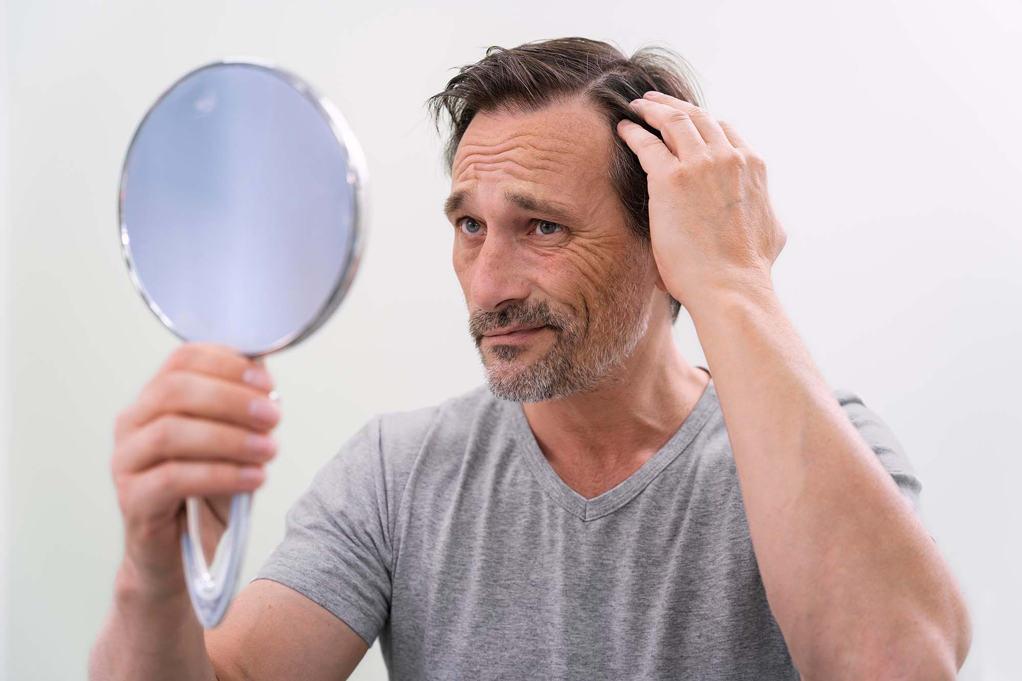 AuraPlastic hair loss Header Image